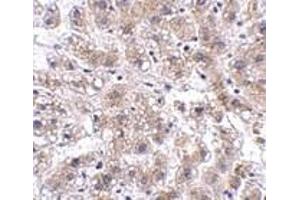 Immunohistochemistry of AFAP1L2 in human liver tissue with AFAP1L2 antibody at 2. (AFAP1L2 antibody  (C-Term))