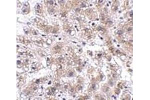 Immunohistochemistry of AFAP1L2 in human liver tissue with AFAP1L2 antibody at 2.