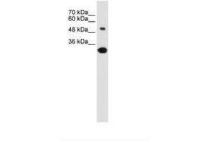 Image no. 1 for anti-Solute Carrier Family 2 (Facilitated Glucose/fructose Transporter), Member 5 (SLC2A5) (AA 300-349) antibody (ABIN6736628) (SLC2A5 antibody  (AA 300-349))