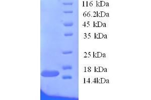 SDS-PAGE (SDS) image for TRAF Family Member-Associated NFKB Activator (TANK) (AA 1-119), (partial) protein (His tag) (ABIN5713870)