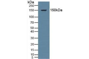 Detection of MR in Human Serum using Polyclonal Antibody to Mineralocorticoid Receptor (MR) (NR3C2 antibody  (AA 739-984))
