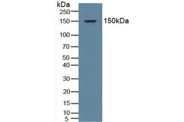 NR3C2 antibody  (AA 739-984)