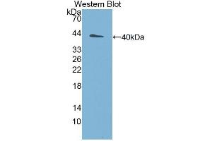 Western Blotting (WB) image for anti-Ubiquitin Protein Ligase E3A (ube3a) (AA 158-407) antibody (ABIN1860894) (ube3a antibody  (AA 158-407))