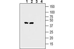 anti-Tetraspanin 7 (TSPAN7) (AA 155-169), (Extracellular) antibody