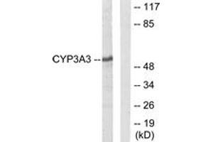 Western blot analysis of extracts from Jurkat cells, using Cytochrome P450 3A4/5 Antibody. (Cytochrome P450 3A4, 3A5 (AA 251-300) antibody)