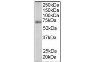 Antibody staining (0. (FNBP1 antibody  (Internal Region))