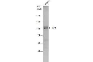 WB Image SP1 antibody detects SP1 protein by western blot analysis.