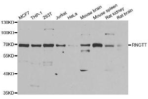 Western blot analysis of extracts of various cell lines, using RNGTT antibody. (RNGTT antibody)