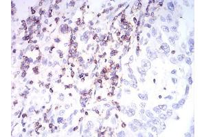 Immunohistochemistry (IHC) image for anti-CD2 (CD2) (AA 25-140) antibody (ABIN5542296)