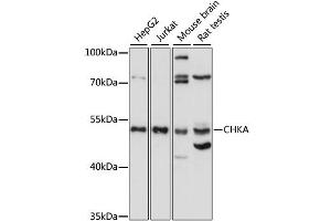 Western blot analysis of extracts of various cell lines, using CHKA antibody (ABIN6294191) at 1:1000 dilution.
