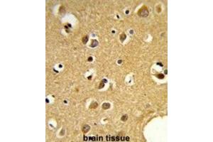Immunohistochemistry (IHC) image for anti-Small Nuclear Ribonucleoprotein Polypeptide C (SNRPC) antibody (ABIN3001664) (SNRPC antibody)