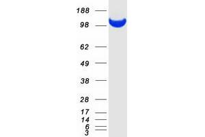 Validation with Western Blot
