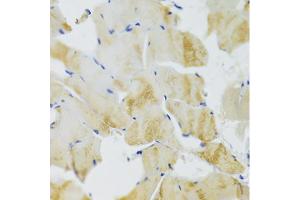Immunohistochemistry of paraffin-embedded rat skeletal muscle using TRAP1 Antibody (ABIN5971463) at dilution of 1/100 (40x lens). (TRAP1 antibody)