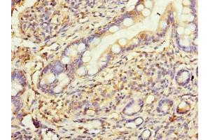 Immunohistochemistry of paraffin-embedded human small intestine tissue using ABIN7175449 at dilution of 1:100 (HSD17B12 antibody  (AA 40-181))
