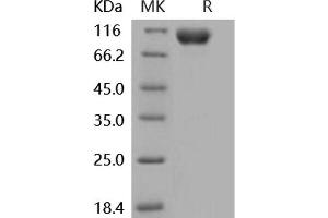 Interleukin 18 Receptor 1 (IL18R1) (Active) protein (His tag,Fc Tag)