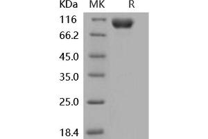 Western Blotting (WB) image for Interleukin 18 Receptor 1 (IL18R1) (Active) protein (His tag,Fc Tag) (ABIN7196449) (IL18R1 Protein (His tag,Fc Tag))