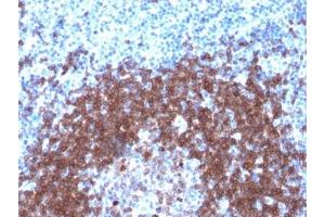 IHC testing of FFPE human tonsil with recombinant CD79a antibody (clone IGA/1790R).