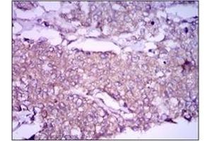 Immunohistochemistry (IHC) image for anti-Glypican 3 (GPC3) antibody (ABIN1107403) (Glypican 3 antibody)