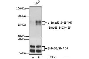 Western blot analysis of extracts of HeLa cells using Phospho-Smad2(S465/467)/Smad3(S423/425) Polyclonal Antibody at dilution of 1:1000. (SMAD2 antibody  (pSer423, pSer425, pSer465, pSer467))