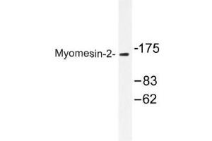 Image no. 1 for anti-Myomesin 2 (MYOM2) antibody (ABIN317920) (MYOM2 antibody)
