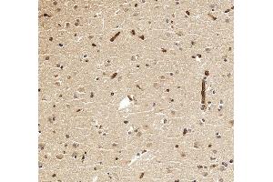 IHC analysis of CHAT using anti-CHAT antibody (ABIN7600920). (Choline Acetyltransferase antibody  (AA 25-731))