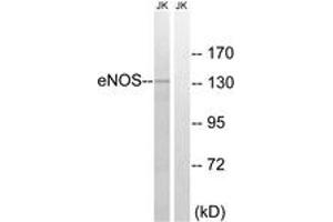 Western blot analysis of extracts from Jurkat cells, treated with Insulin 0. (ENOS antibody  (AA 1144-1193))