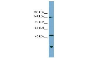 ERCC6L antibody used at 1 ug/ml to detect target protein. (ERCC6L antibody  (N-Term))