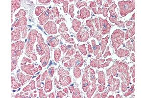 Anti-SLITRK6 antibody IHC of human heart. (SLITRK6 antibody  (Internal Region))