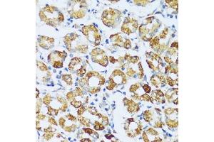 Immunohistochemistry of paraffin-embedded human stomach using C1QC antibody (ABIN7266475) at dilution of 1:100 (40x lens).