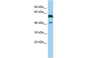 Host: Rabbit Target Name: GPR114 Sample Type: MDA-MB-435S Whole Cell lysates Antibody Dilution: 1. (GPR114 antibody  (Middle Region))