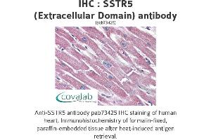 Image no. 2 for anti-Somatostatin Receptor 5 (SSTR5) (2nd Extracellular Domain) antibody (ABIN1739675) (SSTR5 antibody  (2nd Extracellular Domain))