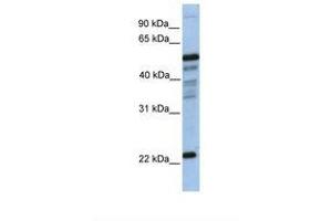 Image no. 1 for anti-Hematopoietic Prostaglandin D Synthase (HPGDS) (N-Term) antibody (ABIN6738498) (HPGDS antibody  (N-Term))
