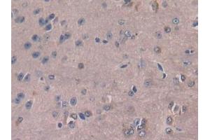 Detection of MCSF in Mouse Cerebrum Tissue using Polyclonal Antibody to Colony Stimulating Factor 1, Macrophage (MCSF) (M-CSF/CSF1 antibody  (AA 33-204))