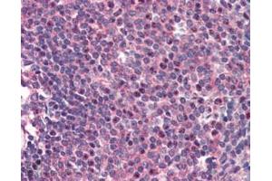 ABIN184957 (2µg/ml) staining of paraffin embedded Human Spleen. (CARD11 antibody  (C-Term))
