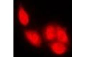 Immunofluorescent analysis of NFAT2 staining in U2OS cells. (NFATC1 antibody)