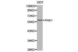 Western Blotting (WB) image for anti-P21-Activated Kinase 1 (PAK1) antibody (ABIN1874026) (PAK1 antibody)