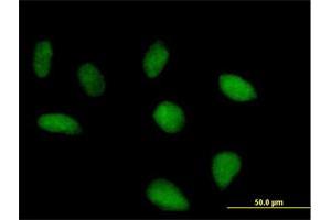 Immunofluorescence of purified MaxPab antibody to FLJ10379 on HeLa cell. (SRBD1 antibody  (AA 1-620))