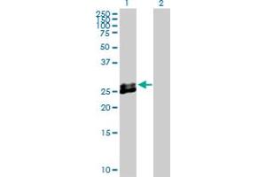 Western Blot analysis of EPDR1 expression in transfected 293T cell line by EPDR1 MaxPab polyclonal antibody. (EPDR1 antibody  (AA 1-224))