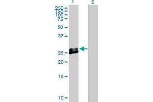 EPDR1 antibody  (AA 1-224)