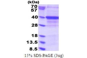 Exosome Component 7 (EXOSC7) (AA 1-291) protein (His tag)