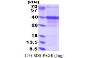 SDS-PAGE (SDS) image for Exosome Component 7 (EXOSC7) (AA 1-291) protein (His tag) (ABIN5853800)