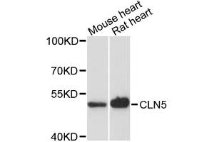 Western blot analysis of extracts of various cell lines, using CLN5 antibody. (CLN5 antibody)