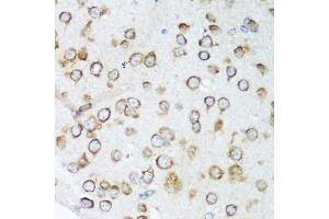 Immunohistochemistry of paraffin-embedded mouse brain using NOTCH2 antibody. (NOTCH2 antibody)