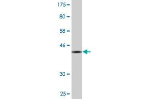 Western Blot detection against Immunogen (36. (ZNF34 antibody  (AA 104-203))