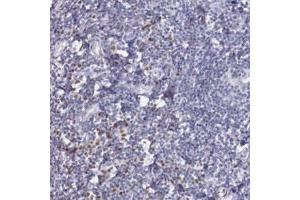 Immunohistochemical staining of human tonsil with IRF4 polyclonal antibody  shows distinct nuclear positivity in subsets of lymphoid cells . (IRF4 antibody)