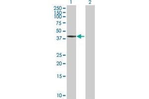 Western Blot analysis of BCS1L expression in transfected 293T cell line by BCS1L MaxPab polyclonal antibody. (BCS1L antibody  (AA 1-419))
