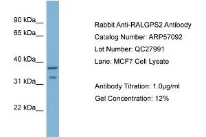 WB Suggested Anti-RALGPS2  Antibody Titration: 0.