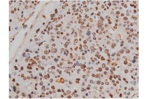 Immunohistochemistry (IHC) image for anti-Filamin A, alpha (FLNA) (pSer2152) antibody (ABIN6256196)
