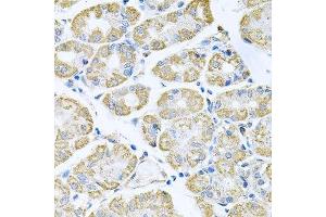 Immunohistochemistry of paraffin-embedded human stomach using TNFRSF10A antibody. (TNFRSF10A antibody  (AA 269-468))