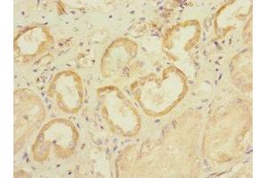 Immunohistochemistry of paraffin-embedded human kidney tissue using ABIN7170032 at dilution of 1:100 (SLC28A1 antibody  (AA 1-80))